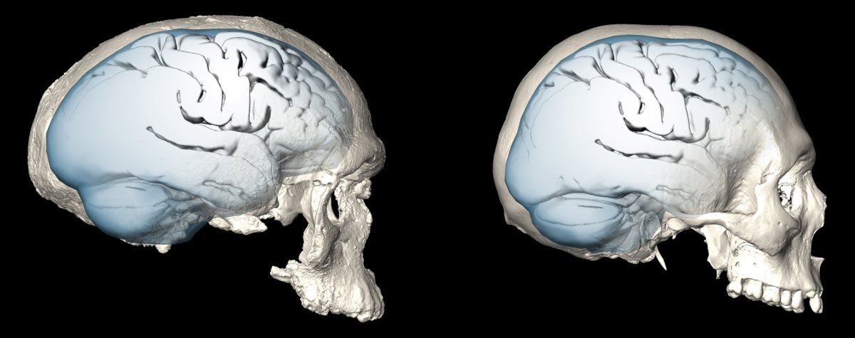 Mind bender: shape of human brain evolved over time