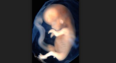 20-week abortion ban, abortion ban, abortion, house passes abortion ban, fetal pain