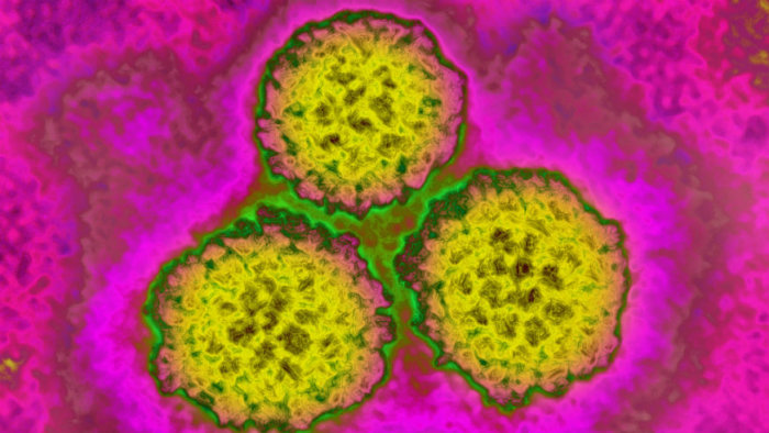 HPV Outbreak Rumors