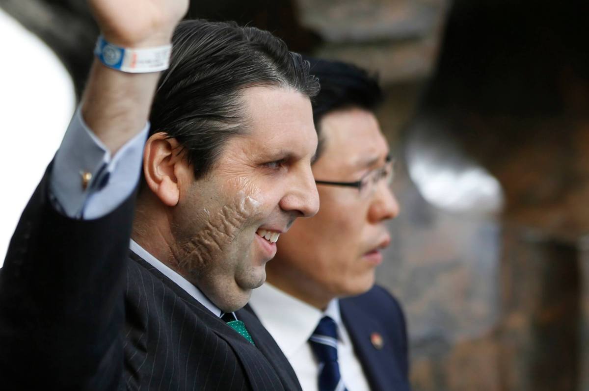 U.S. envoy to South Korea defiant after 80-stitch knife attack