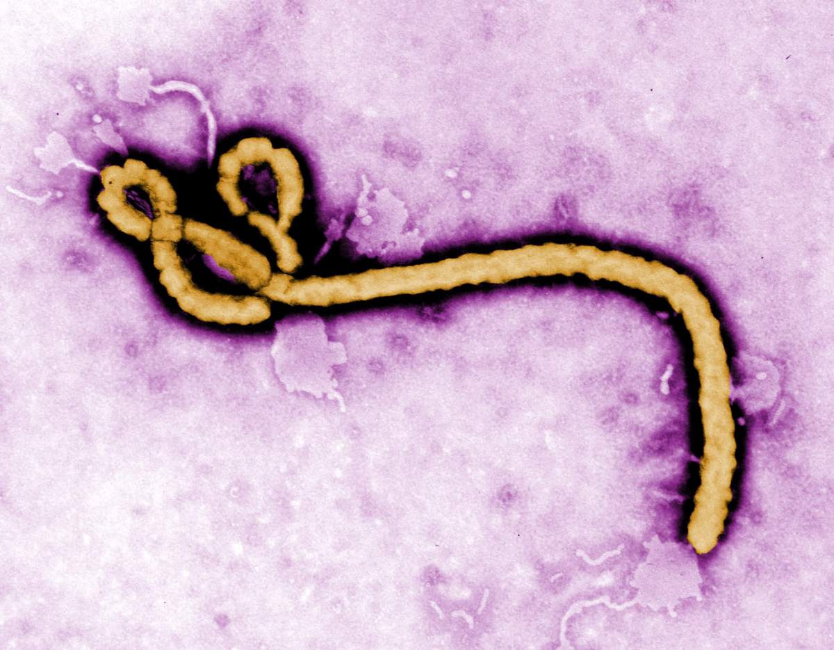 Bronx boy tests negative for Ebola