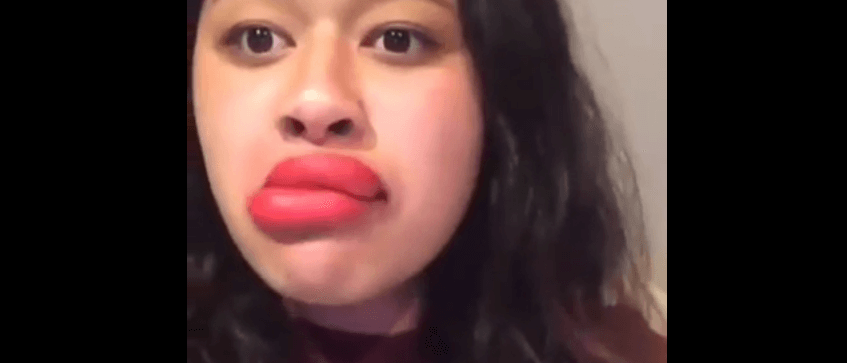 Kylie Jenner Challenge: Teens use shot glasses to make lips swell