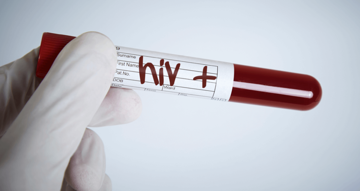 London hospital releases identities of HIV positive patients