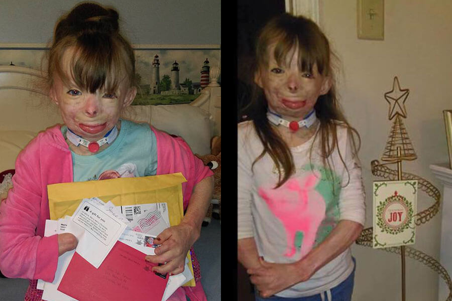 This 8-year-old burn victim only wants one thing for Christmas