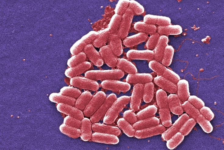 ‘Superbug’ reported for second time in U.S.