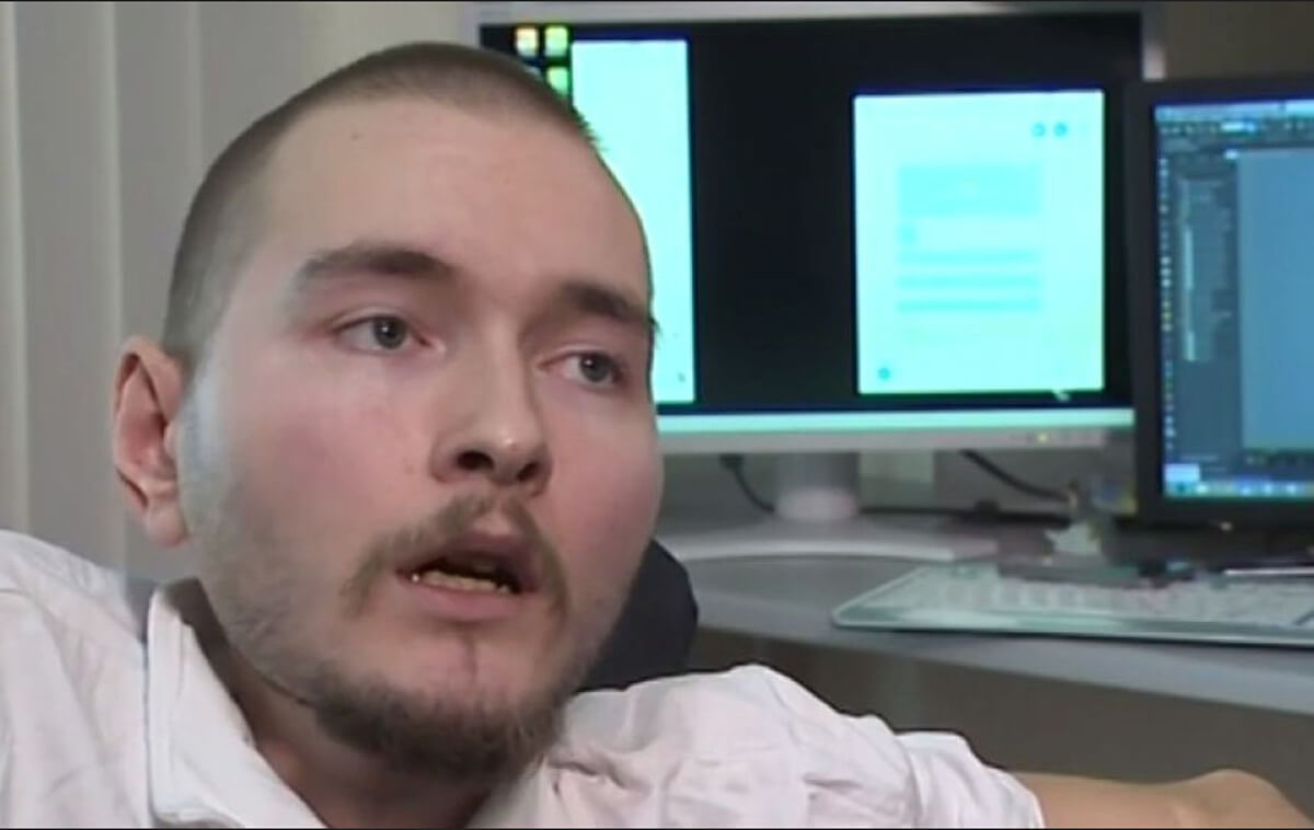OMG: Russian man may be first person to receive head transplant