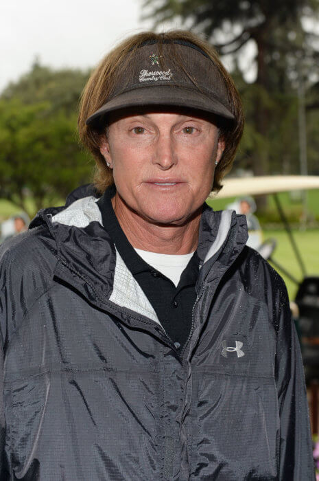 10 sex changes as stunning as Bruce Jenner’s