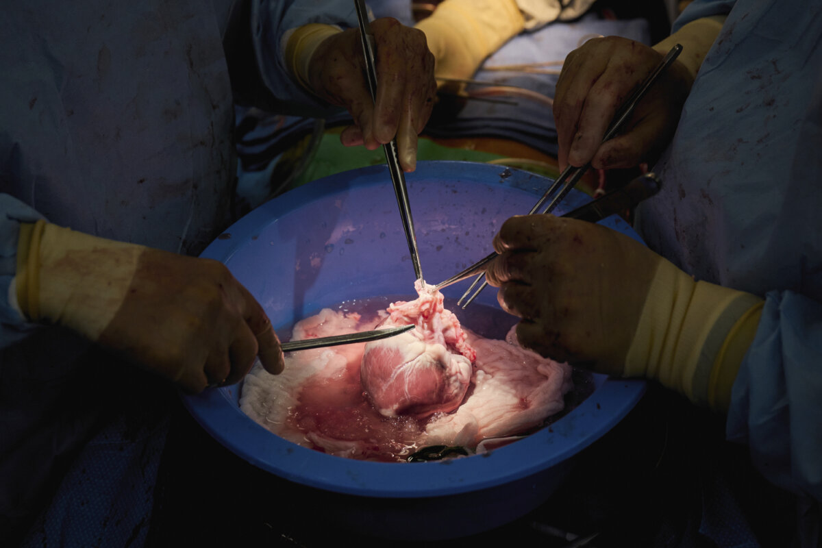 Pig-Human Transplants