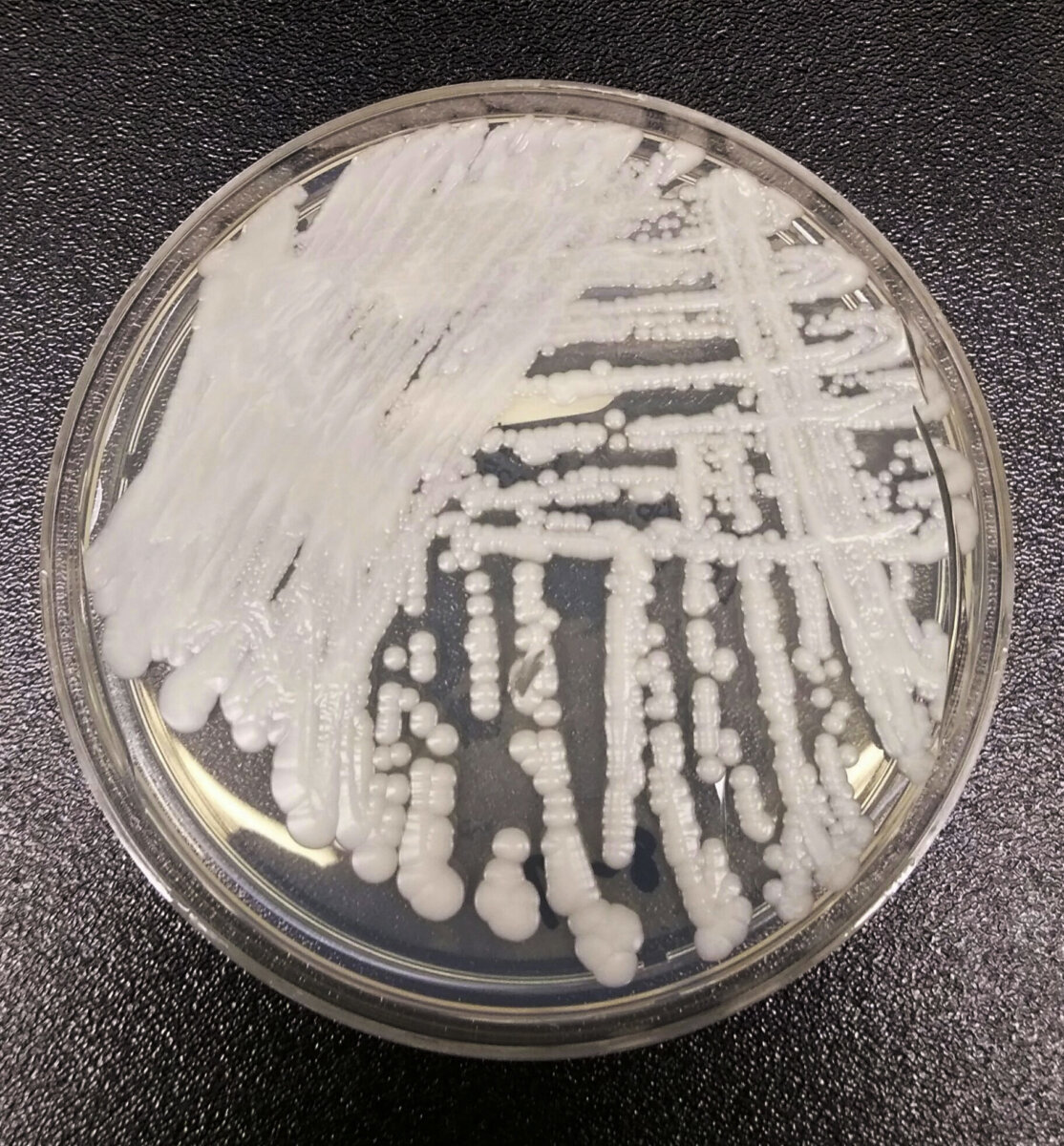 Superbug Fungus