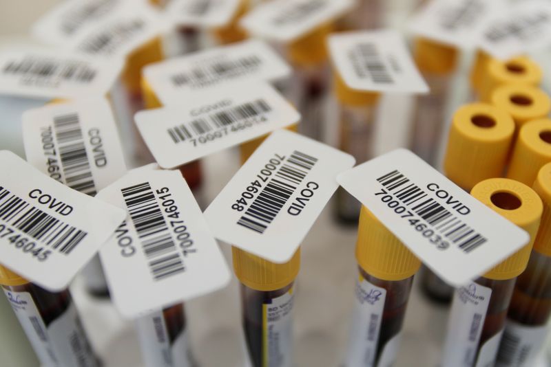 Vials with blood samples are pictured at a clinic providing