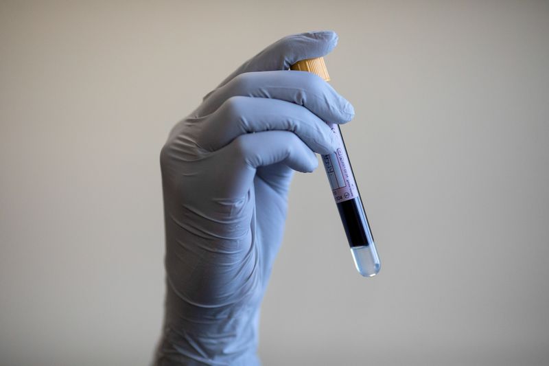 FILE PHOTO: NHS staff at antibody testing hub run by