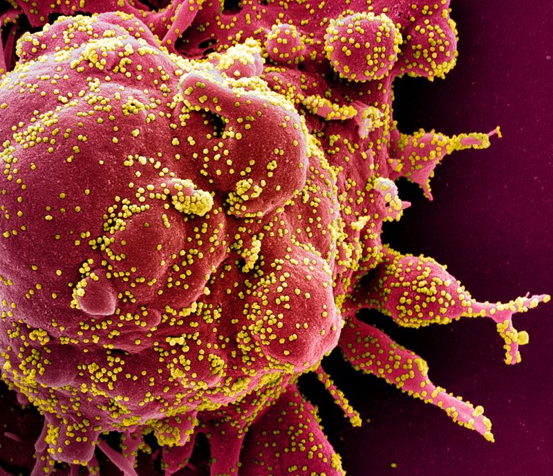 FILE PHOTO: Colorized scanning electron micrograph of apoptotic cell infected