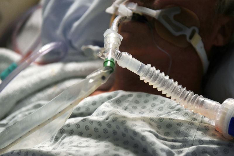 A patient on a ventilator is seen as medical professionals