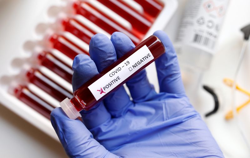 Fake blood is seen in test tubes labelled with the
