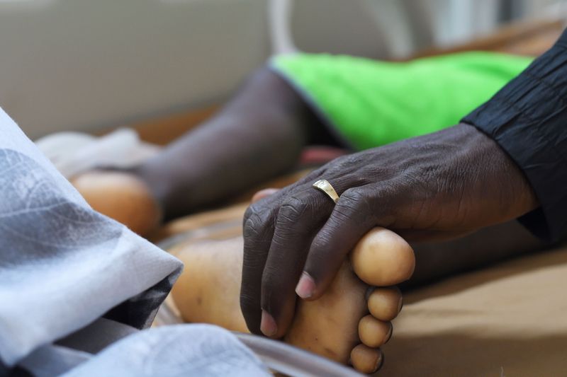 Children in Burkina Faso undergo historic open heart surgeries