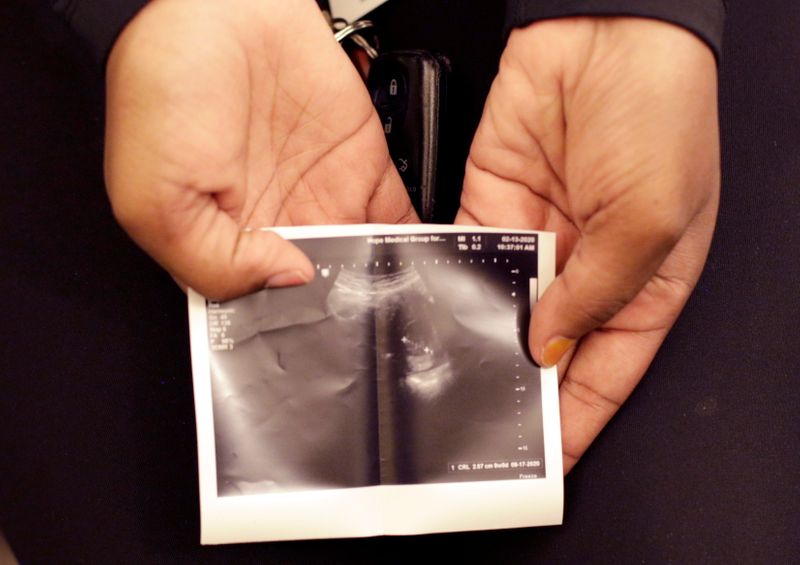FILE PHOTO: A patient from Texas holds a sonogram that