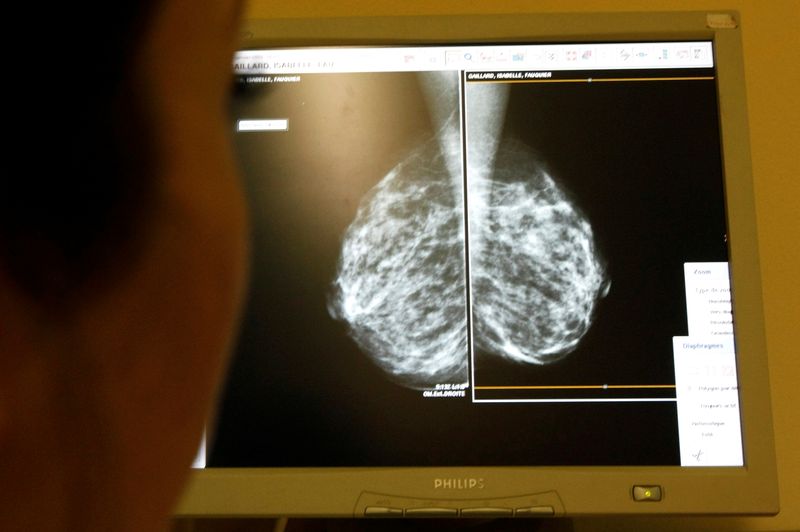 FILE PHOTO: A woman undergoes a mammograms, a special type