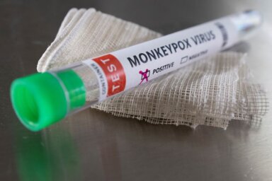 Illustration shows test tube labelled “Monkeypox virus positive