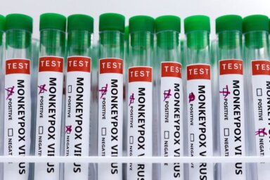 Illustration shows test tubes labelled “Monkeypox virus positive and negative