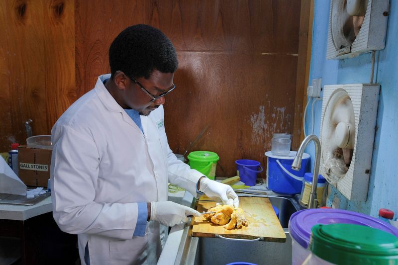 Dr. Kafui Akakpo, a pathologist, observes a breast lump with
