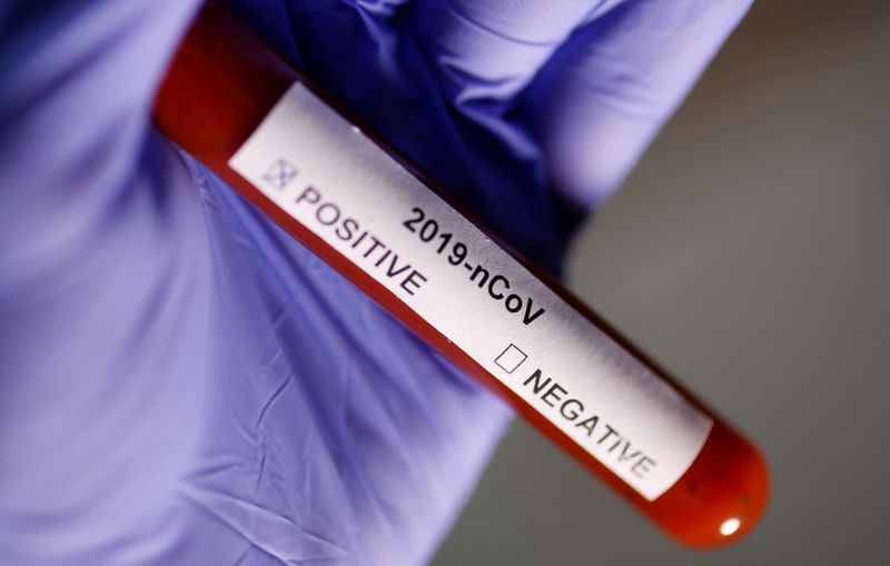 FILE PHOTO: Test tube with Corona virus name label is