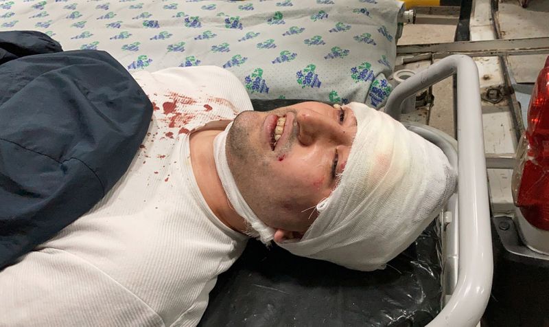 Blogger Miraziz Bazarov lies on a stretcher upon his arrival